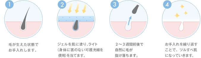 サロンの光脱毛イメージ